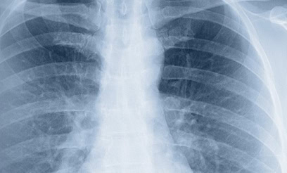 asbestos accountability for injuries