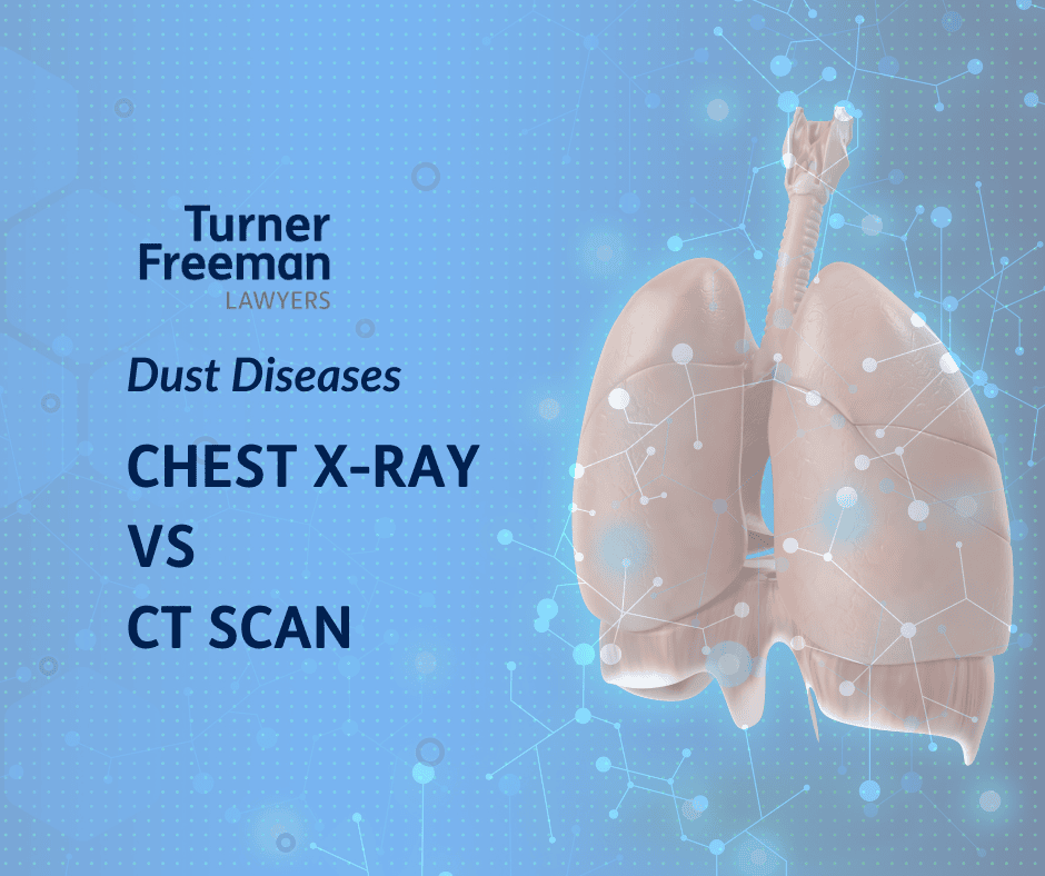 Dust Diseases: Chest x-ray vs CT scan