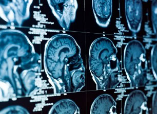 Mental disorders and TPD claims