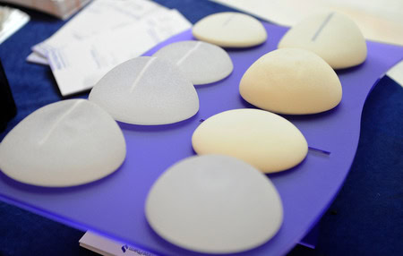 Breast implants causing cancer