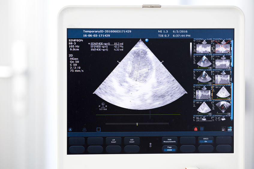 Failed diagnosis medical negligence