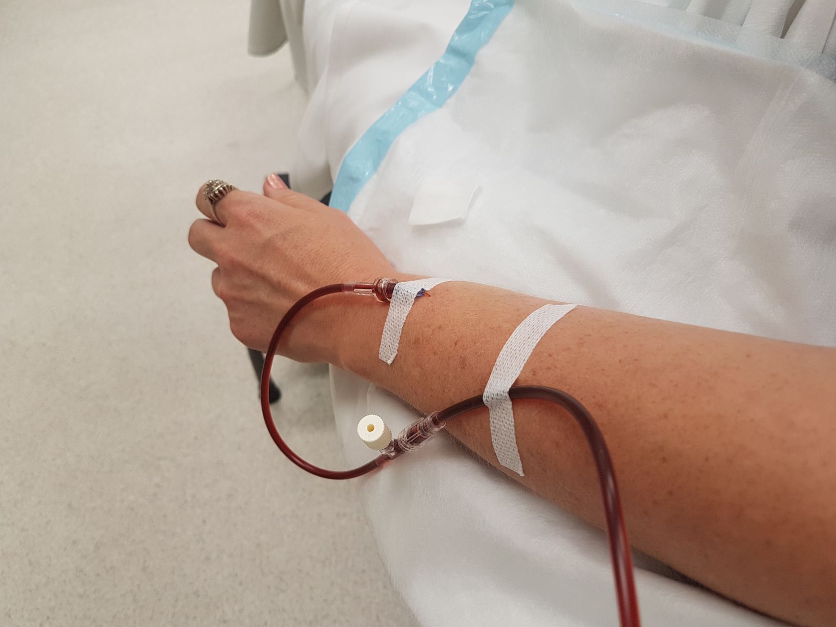 Iron infusions, a procedure to treat iron deficiency and anaemia