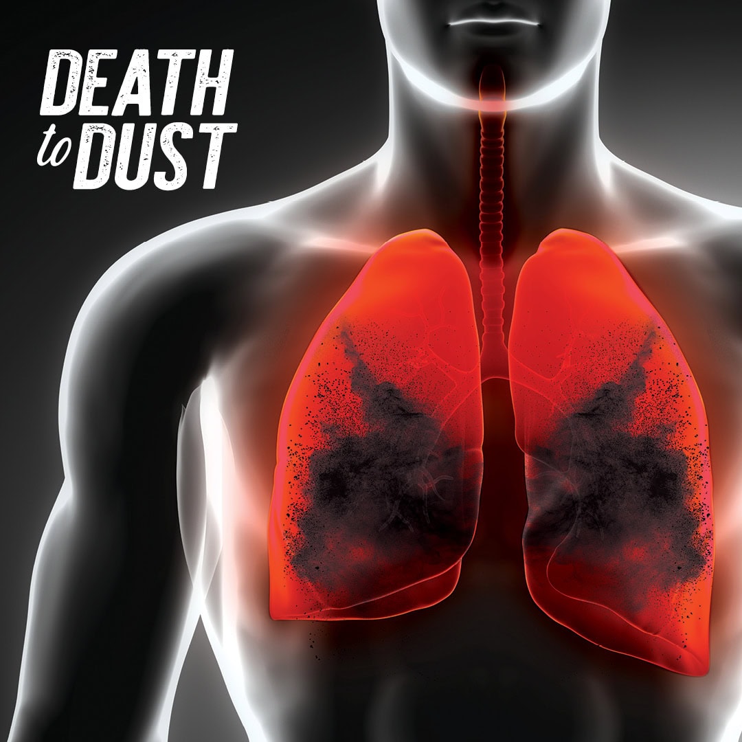 Knowing your Rights I was diagnosed with mesothelioma, but I never worked with asbestos products during my employment.