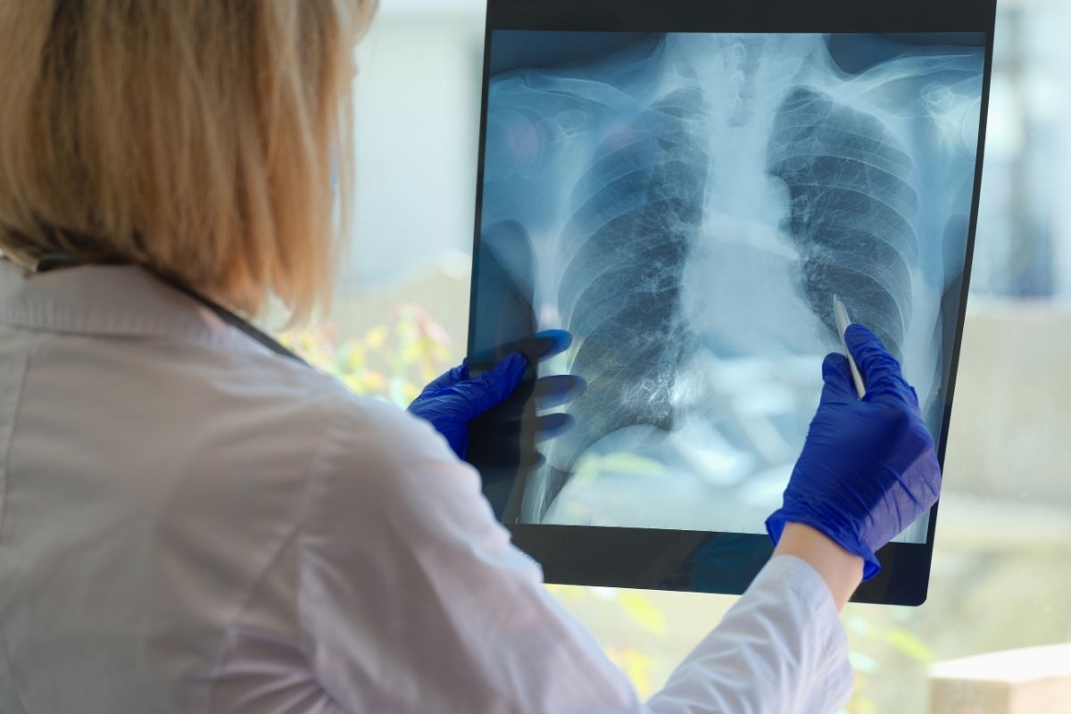 Doctor looking at lung screening