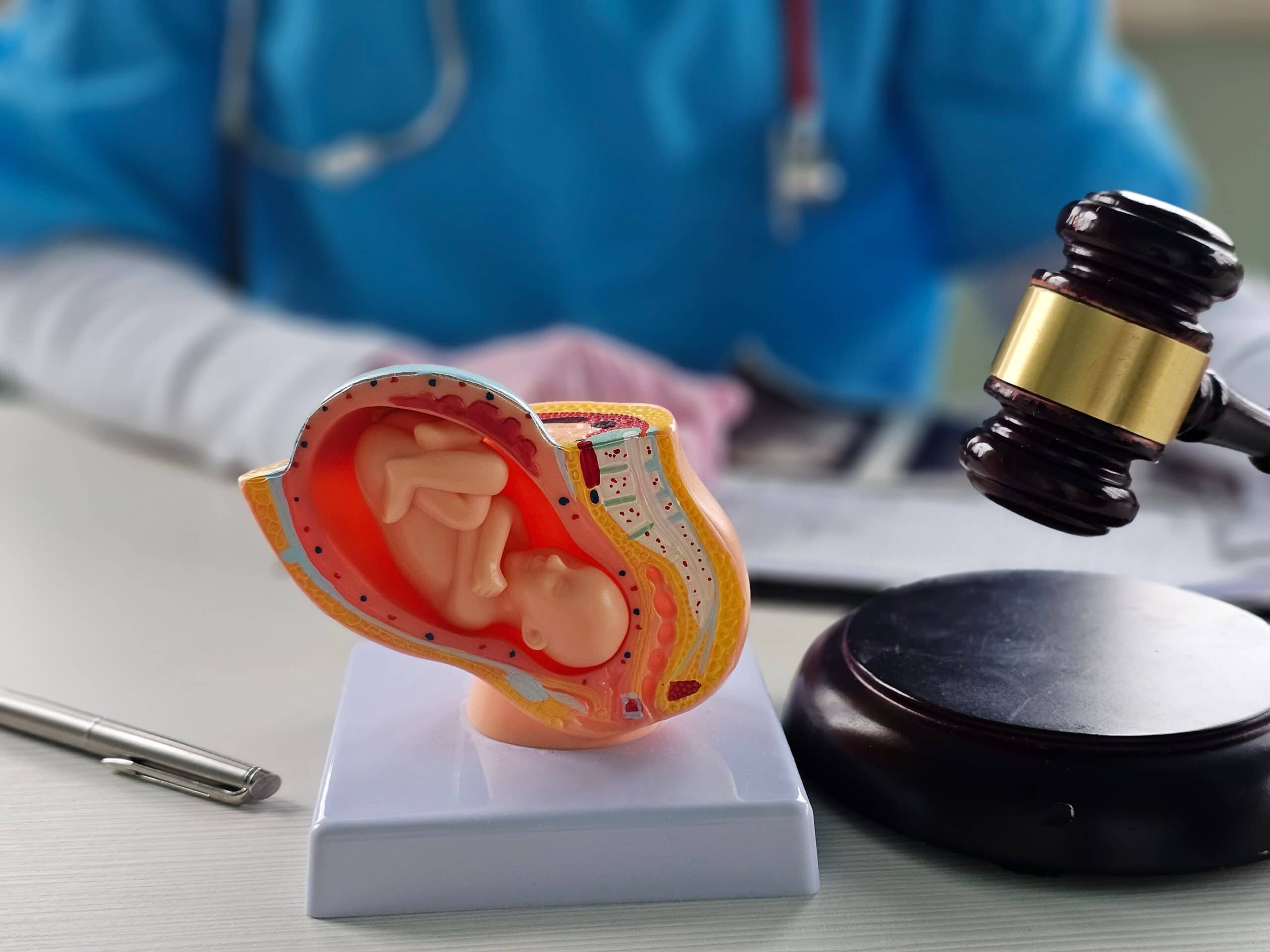 legal and medical considerations in childbirth with anatomical model of child in utero