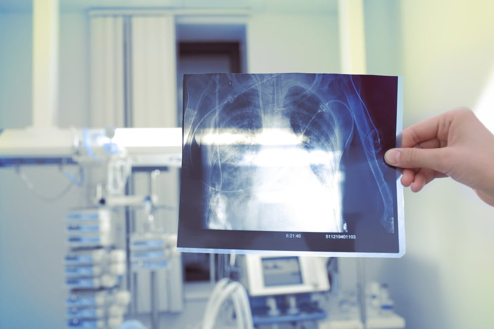 x ray,image,in,doctors,hand.