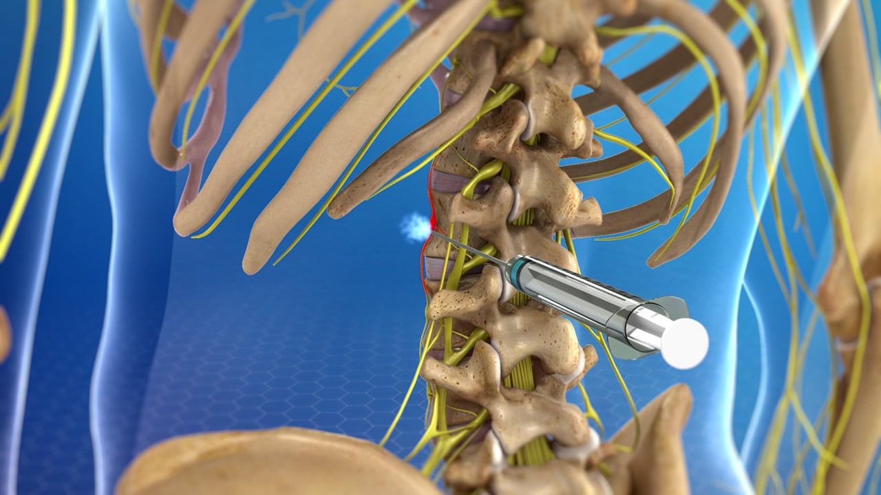 Medical negligence injuries